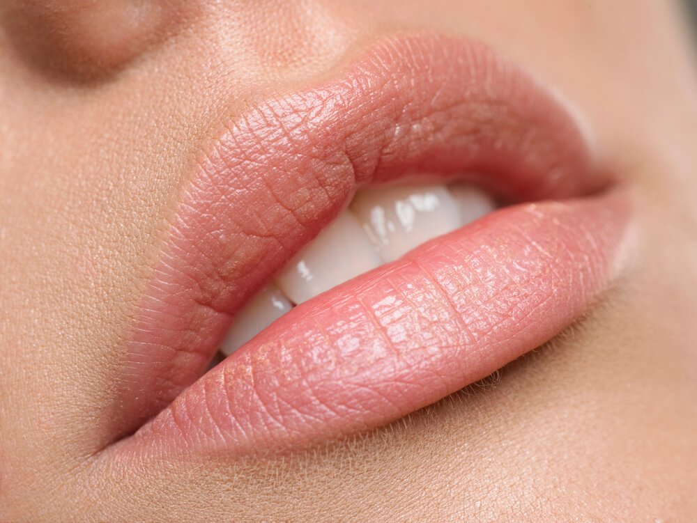 At what age do lips start to thin?